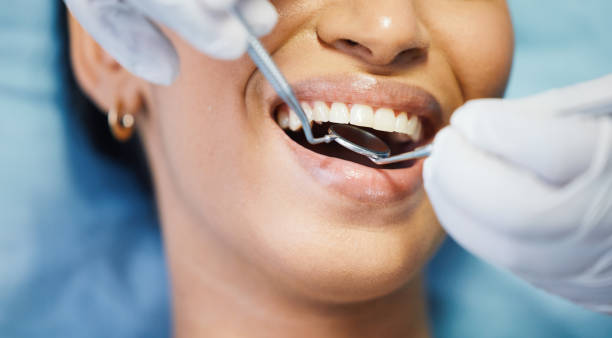 Best Knocked-Out Tooth Emergency  in Kentwood, LA
